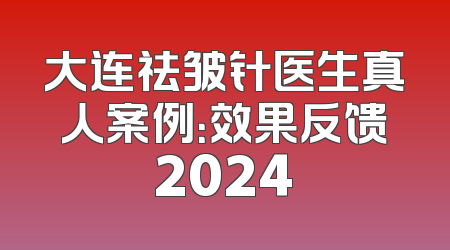 大连祛皱针医生真人案例：效果反馈2024