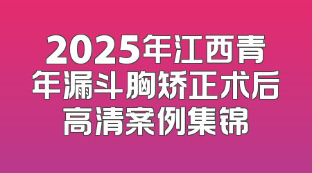2025年江西青年漏斗胸矫正术后高清案例集锦