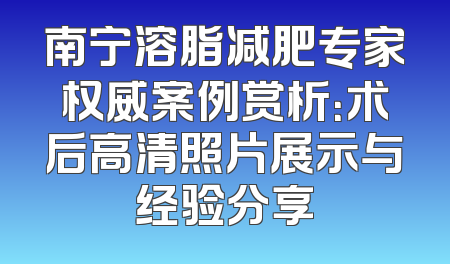 南宁溶脂减肥专家权威案例赏析：术后高清照片展示与经验分享