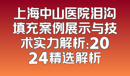 上海中山医院泪沟填充案例展示与技术实力解析：2024精选解析