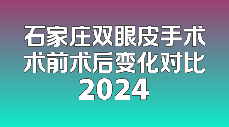 石家庄双眼皮手术术前术后变化对比2024