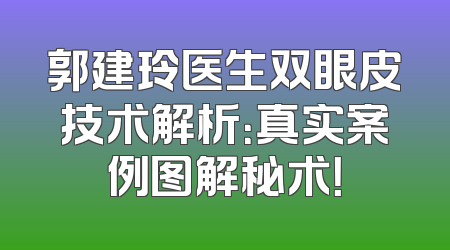 郭建玲医生双眼皮技术解析：真实案例图解秘术！