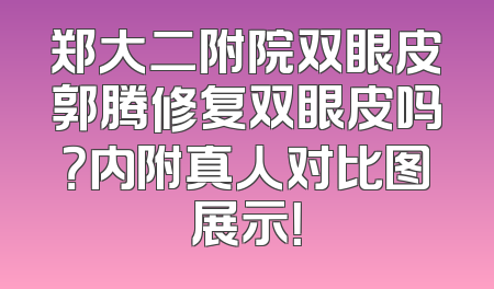 郑大二附院双眼皮郭腾修复双眼皮吗？内附真人对比图展示！