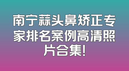 南宁蒜头鼻矫正专家排名案例高清照片合集！