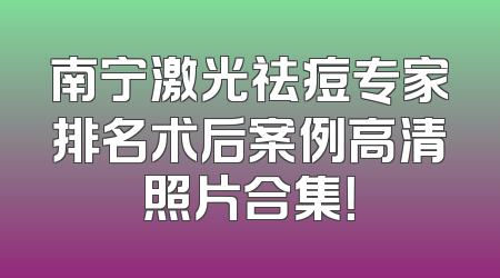 南宁激光祛痘专家排名术后案例高清照片合集！