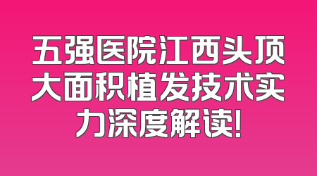 五强医院江西头顶大面积植发技术实力深度解读！