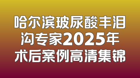 哈尔滨玻尿酸丰泪沟专家2025年术后案例高清集锦