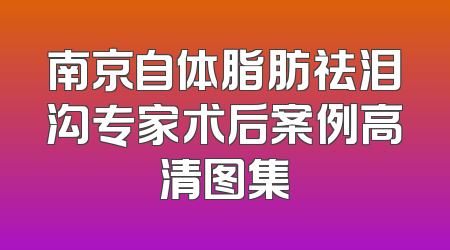 南京自体脂肪祛泪沟专家术后案例高清图集
