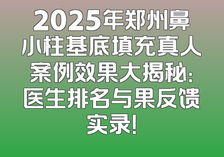 2025年郑州鼻小柱基底填充真人案例效果大揭秘：医生排名与果反馈实录！