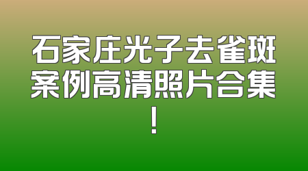 石家庄光子去雀斑案例高清照片合集！