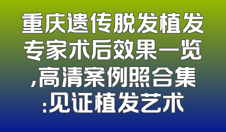 重庆遗传脱发植发专家术后效果一览，高清案例照合集：见证植发艺术
