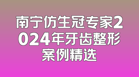 南宁仿生冠专家2024年牙齿整形案例精选