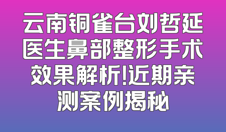 云南铜雀台刘哲延医生鼻部整形手术效果解析！近期亲测案例揭秘