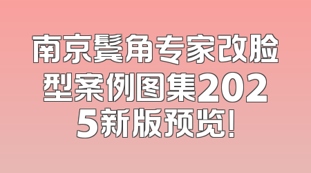 南京鬓角专家改脸型案例图集2025新版预览！