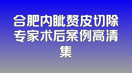 合肥内眦赘皮切除专家术后案例高清集