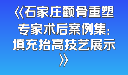 《石家庄颧骨重塑专家术后案例集：填充抬高技艺展示》